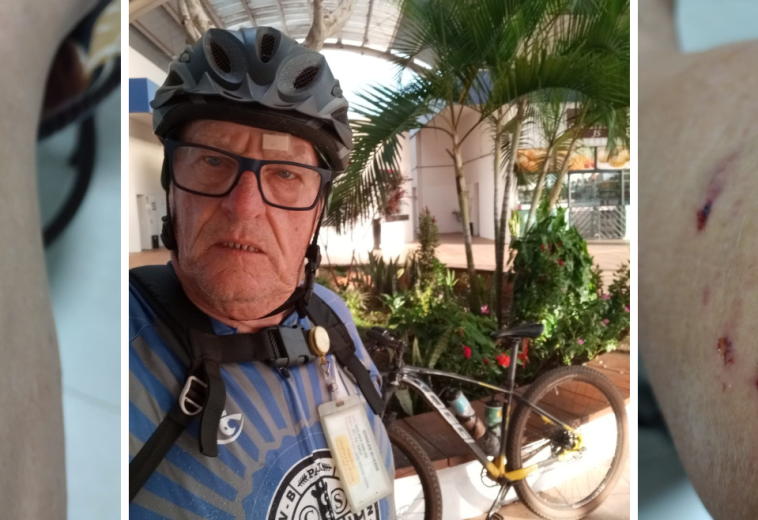 Ataque de pitbulls em estrada rural assusta ciclista de 69 anos: “Poderia ter sido uma tragédia”